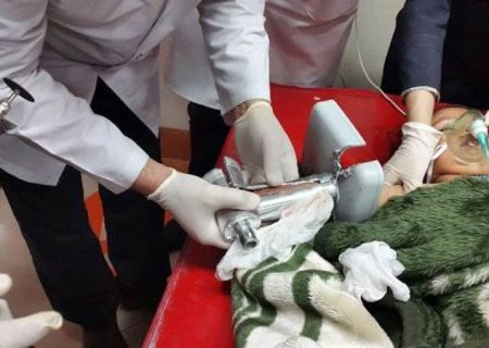 گوشت دست پسر کنجکاو بوکانی را بلعید
