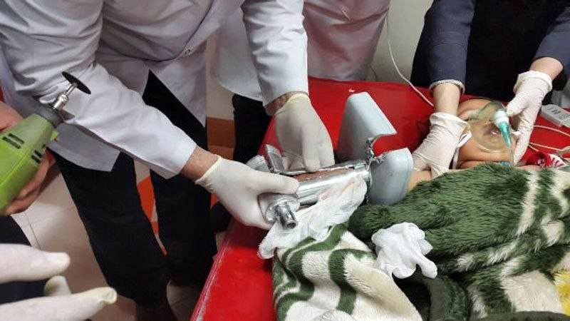 گوشت دست پسر کنجکاو بوکانی را بلعید